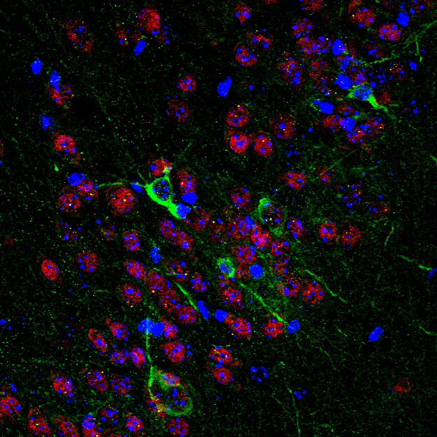 Neuroanatomía funcional de enfermedades raras