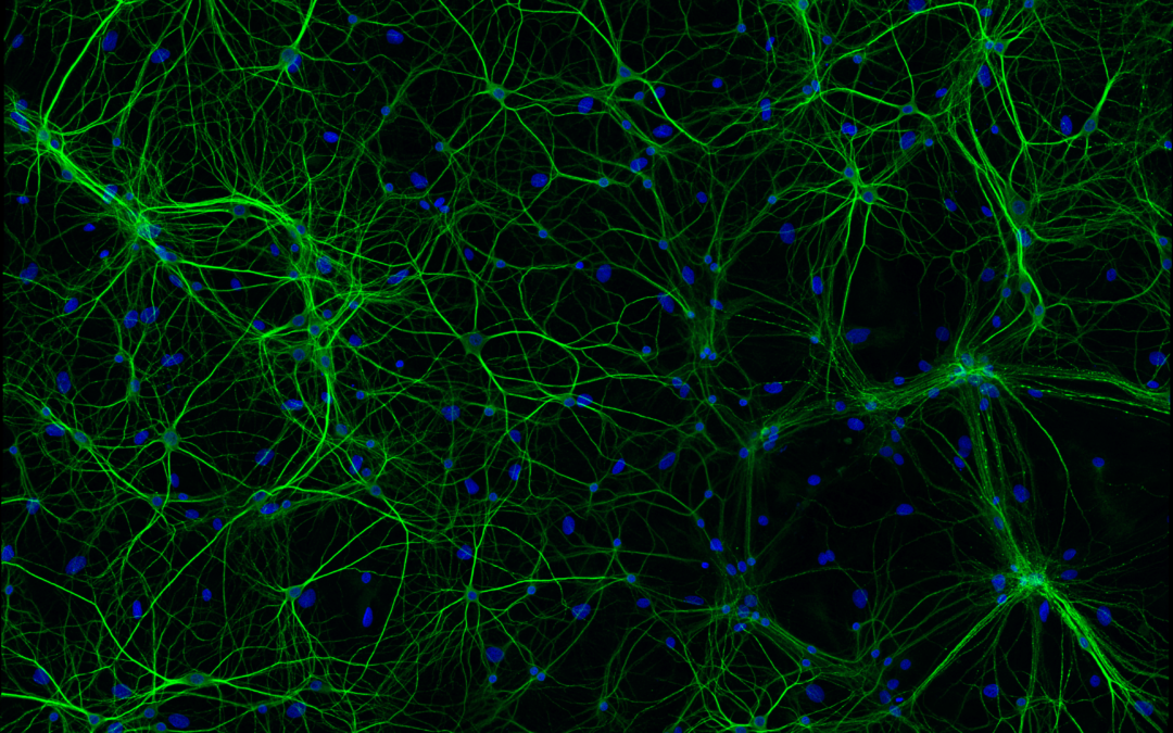 Mecanismos Moleculares en Neurodegeneración (MMN)