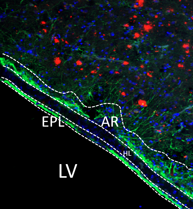 Neurogénesis y Neuroestereología