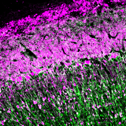 Neurobiología Evolutiva y del Desarrollo